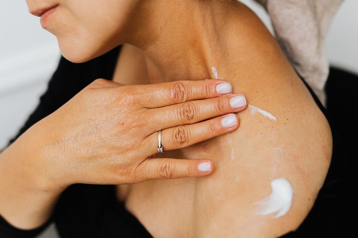 Mulher aplicando creme na pele do ombro